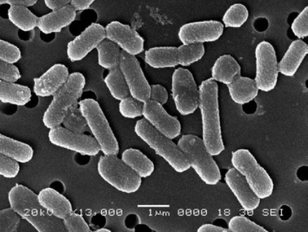 Бактерии резко поменяли окружающую среду перед вымиранием